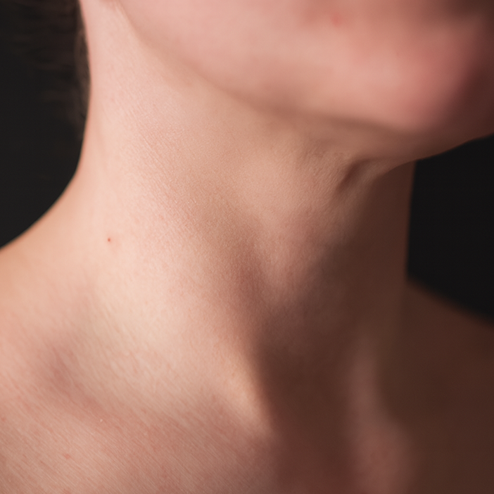 Eczema After
