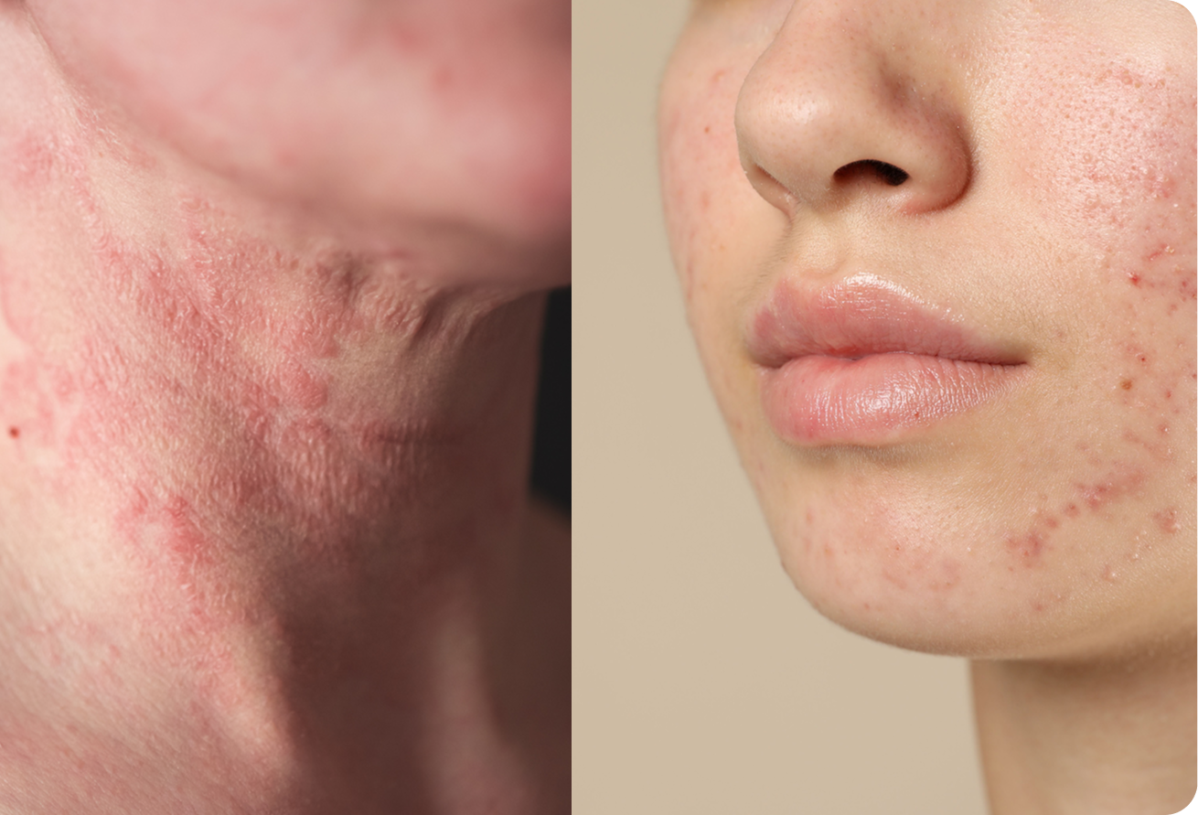 Close-up of skin showing texture and pores